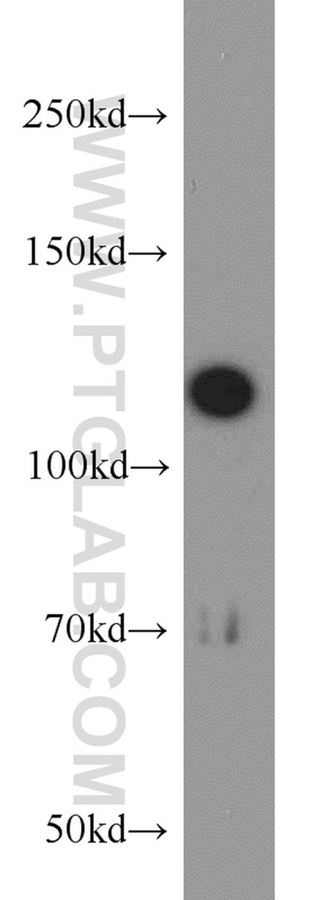 ABLIM1 Antibody in Western Blot (WB)