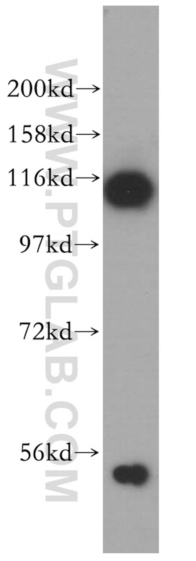 ABLIM1 Antibody in Western Blot (WB)