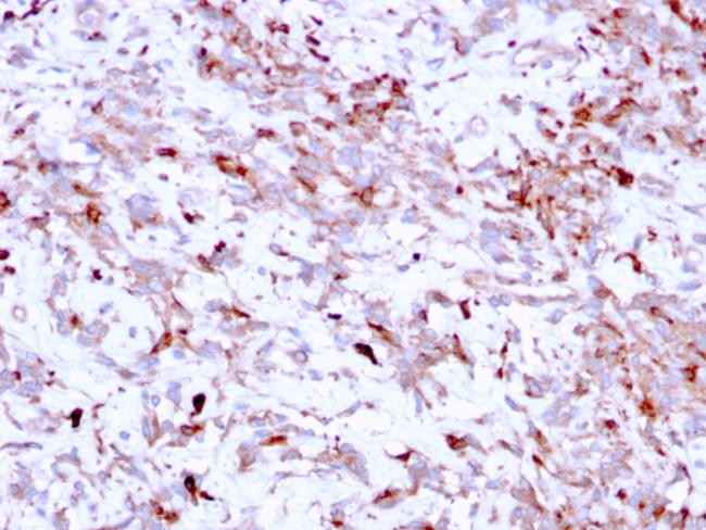 Cathepsin K Antibody in Immunohistochemistry (Paraffin) (IHC (P))