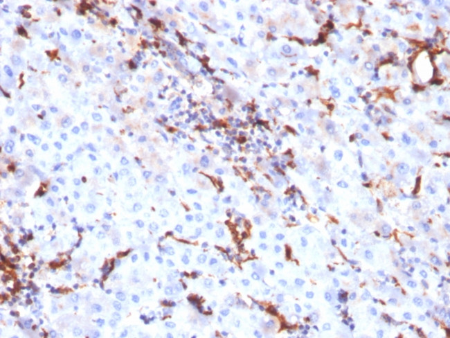 Cathepsin K Antibody in Immunohistochemistry (Paraffin) (IHC (P))