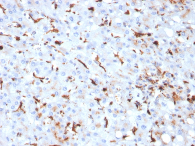 Cathepsin K Antibody in Immunohistochemistry (Paraffin) (IHC (P))