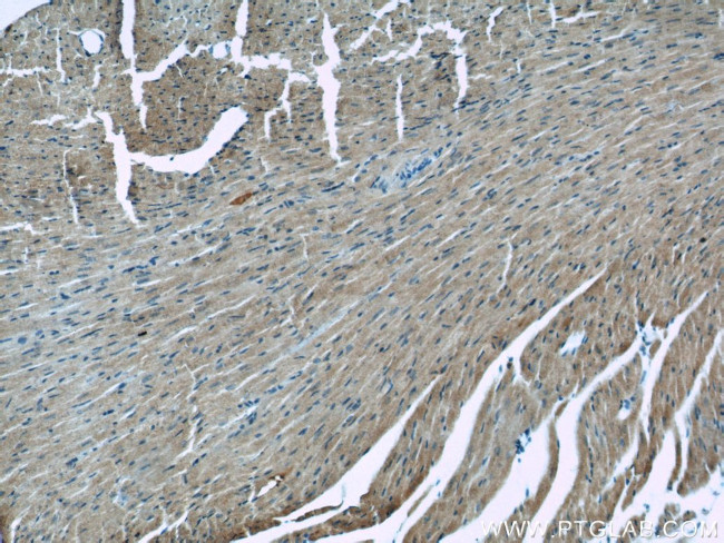 ATG4B Antibody in Immunohistochemistry (Paraffin) (IHC (P))