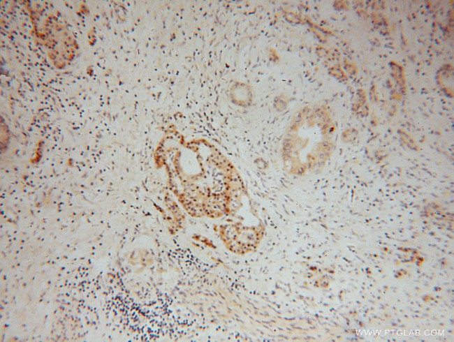 ATG4B Antibody in Immunohistochemistry (Paraffin) (IHC (P))