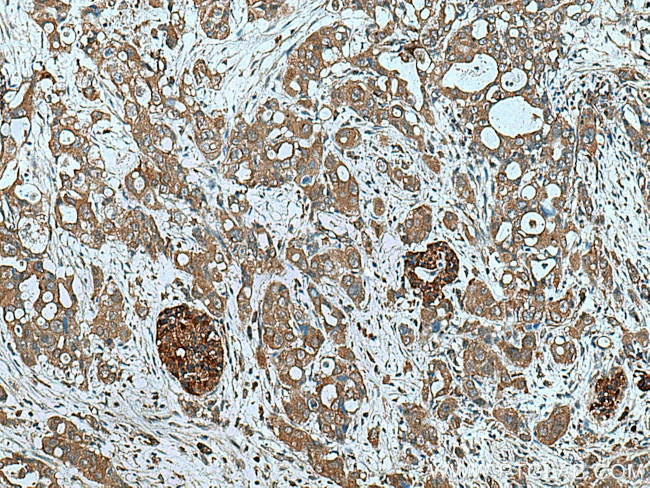 ATG4B Antibody in Immunohistochemistry (Paraffin) (IHC (P))