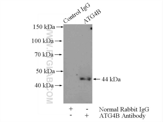 ATG4B Antibody in Immunoprecipitation (IP)