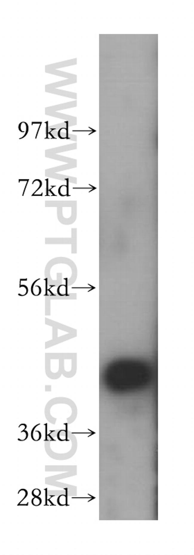 ATG4B Antibody in Western Blot (WB)