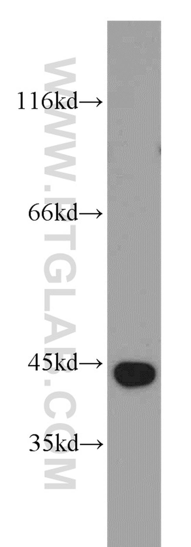 ATG4B Antibody in Western Blot (WB)