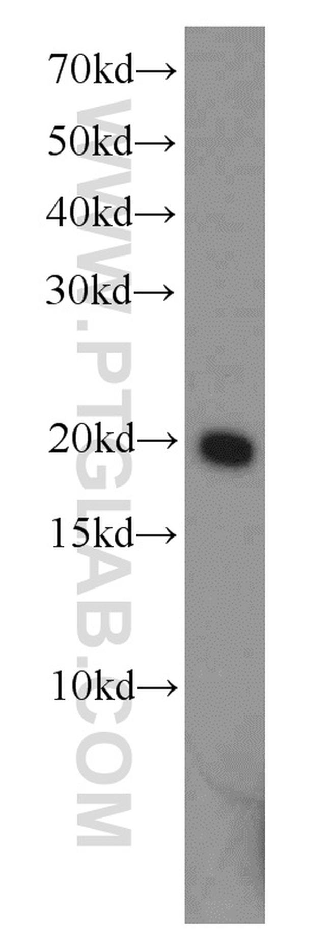 ADI1 Antibody in Western Blot (WB)