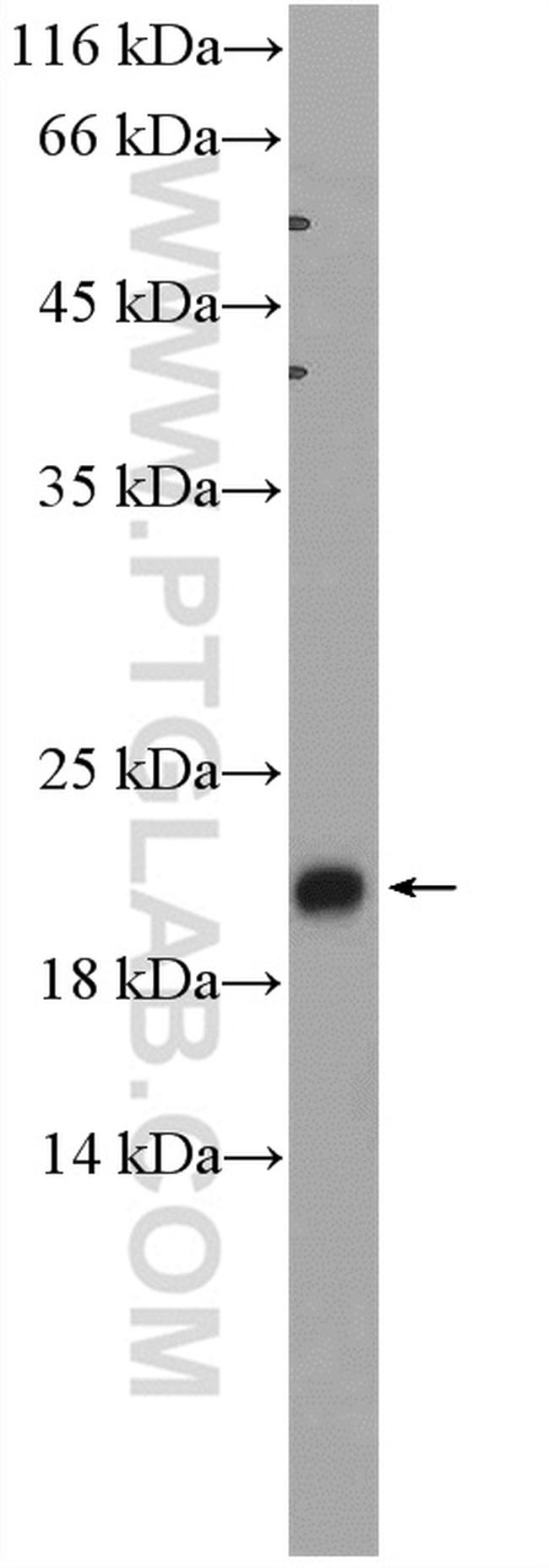 ADI1 Antibody in Western Blot (WB)