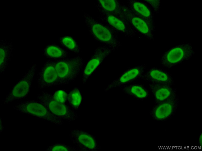 HRP 2 Antibody in Immunocytochemistry (ICC/IF)