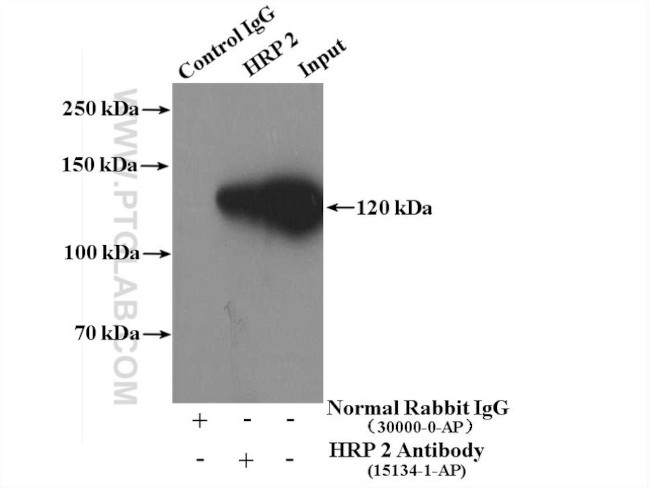 HRP 2 Antibody in Immunoprecipitation (IP)