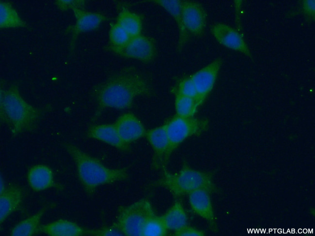 NME3 Antibody in Immunocytochemistry (ICC/IF)