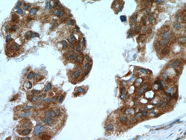 NME3 Antibody in Immunohistochemistry (Paraffin) (IHC (P))