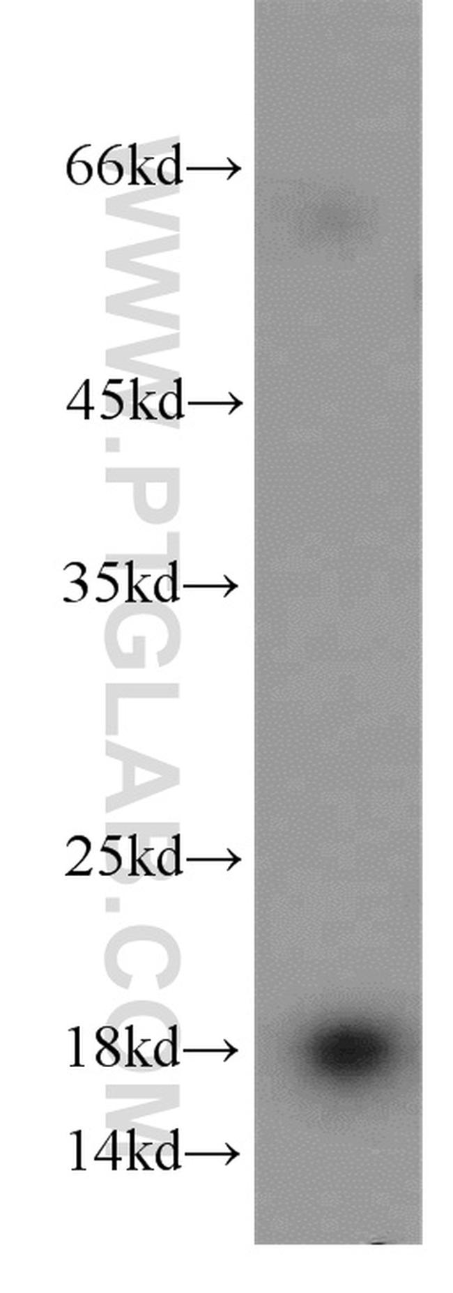 NME3 Antibody in Western Blot (WB)