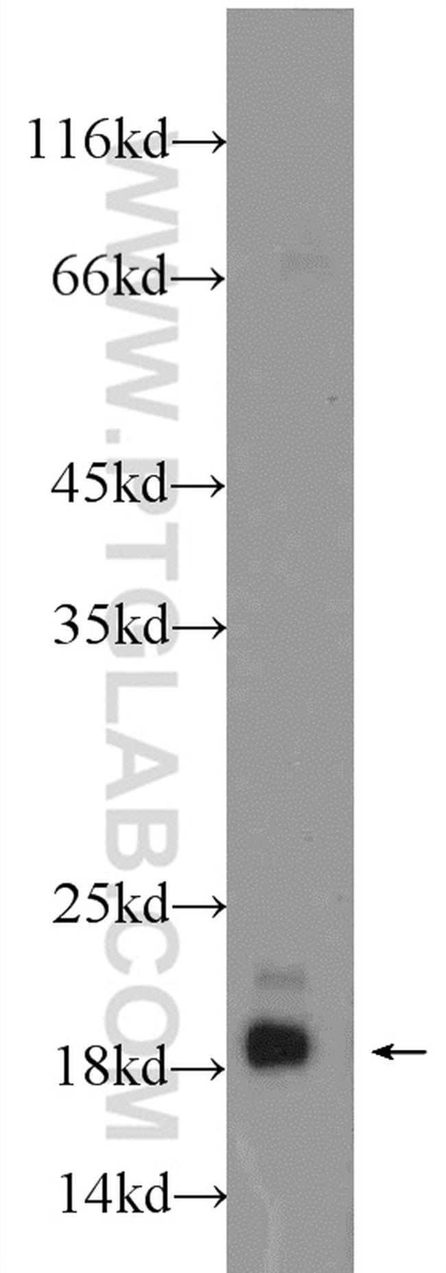 NME3 Antibody in Western Blot (WB)