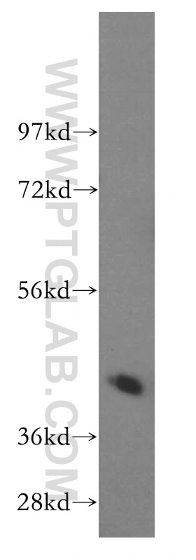 Creatine kinase B type Antibody in Western Blot (WB)