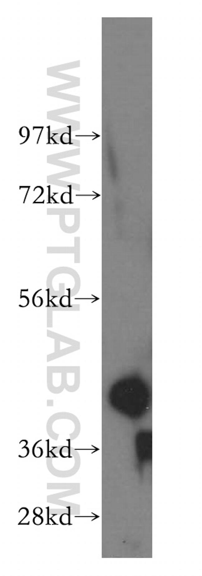 Creatine kinase B type Antibody in Western Blot (WB)