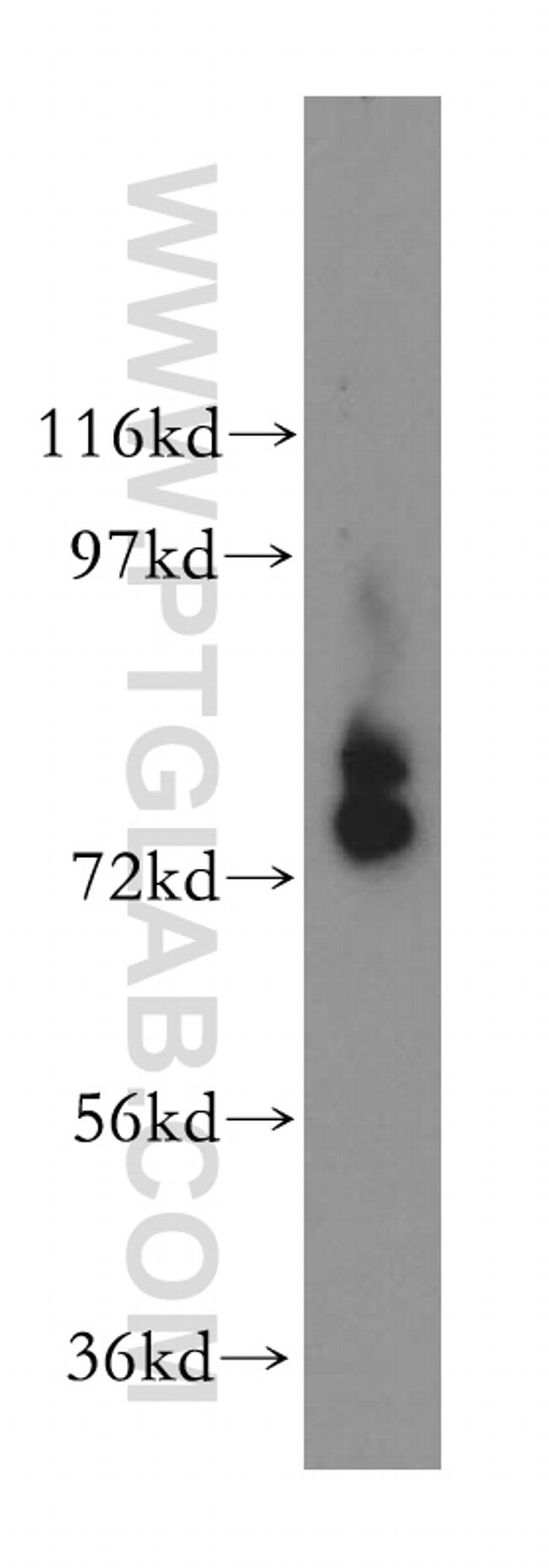 INPP5B Antibody in Western Blot (WB)