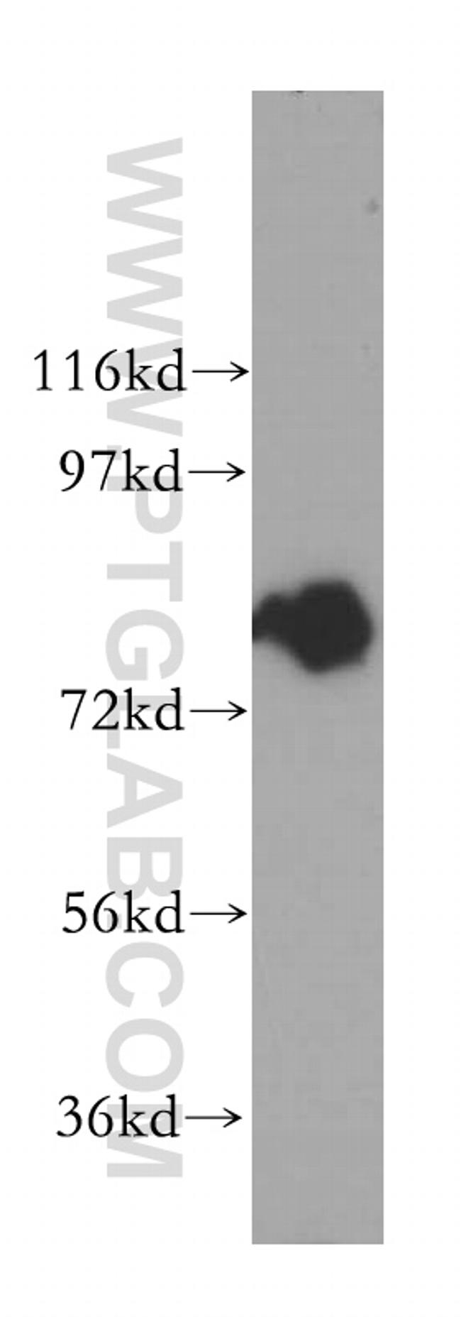 INPP5B Antibody in Western Blot (WB)