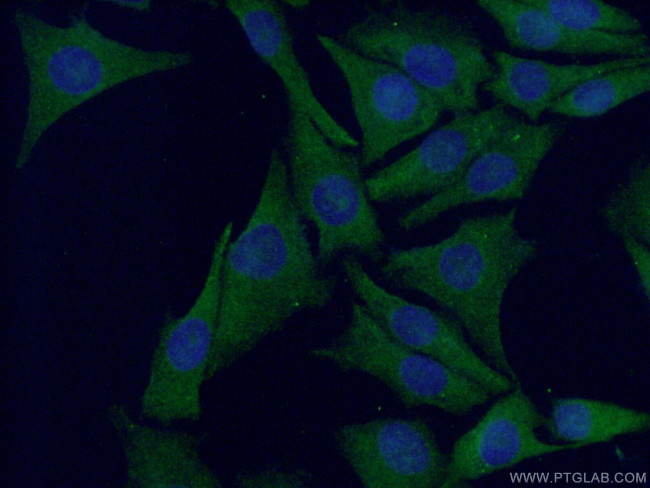 S100 beta Antibody in Immunocytochemistry (ICC/IF)