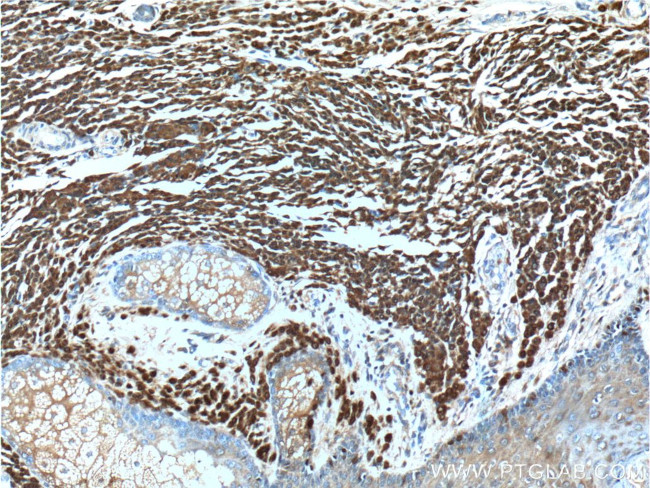 S100 beta Antibody in Immunohistochemistry (Paraffin) (IHC (P))