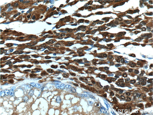 S100 beta Antibody in Immunohistochemistry (Paraffin) (IHC (P))