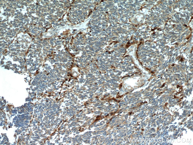 S100 beta Antibody in Immunohistochemistry (Paraffin) (IHC (P))