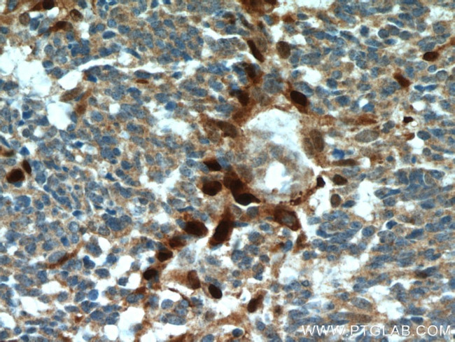 S100 beta Antibody in Immunohistochemistry (Paraffin) (IHC (P))