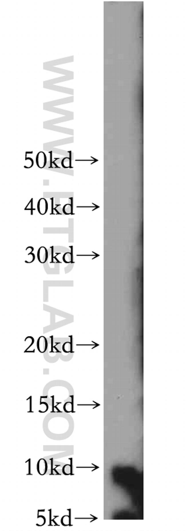 S100 beta Antibody in Western Blot (WB)