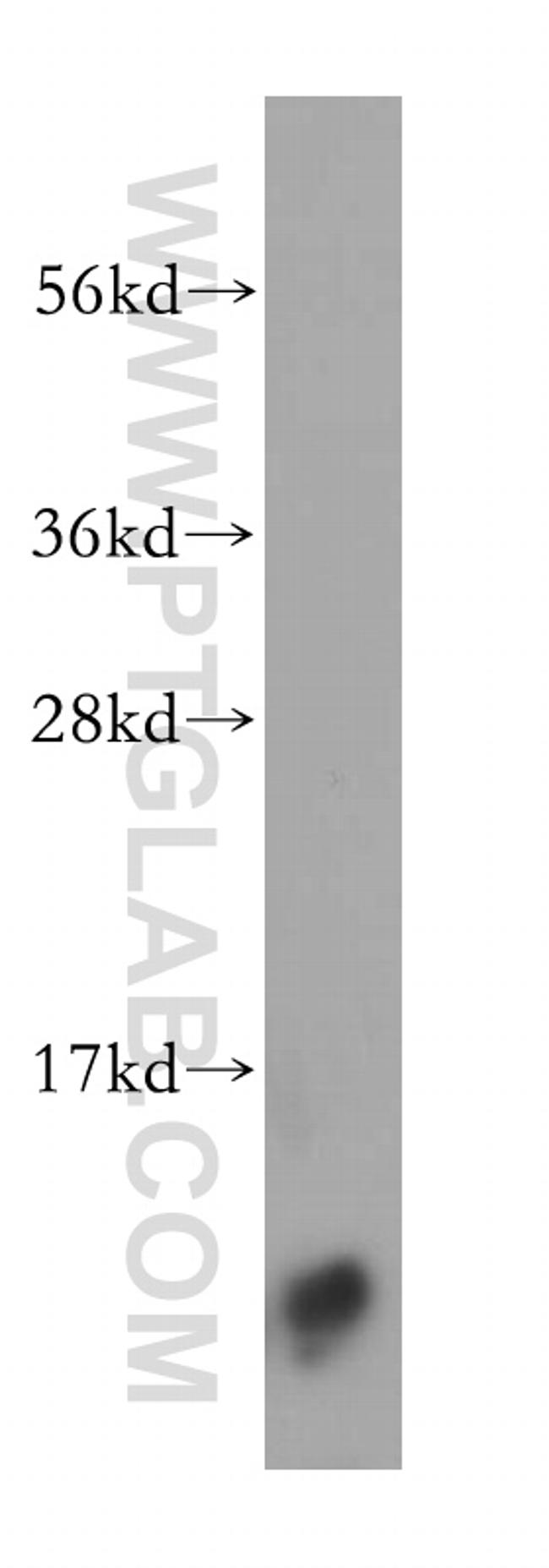 S100 beta Antibody in Western Blot (WB)