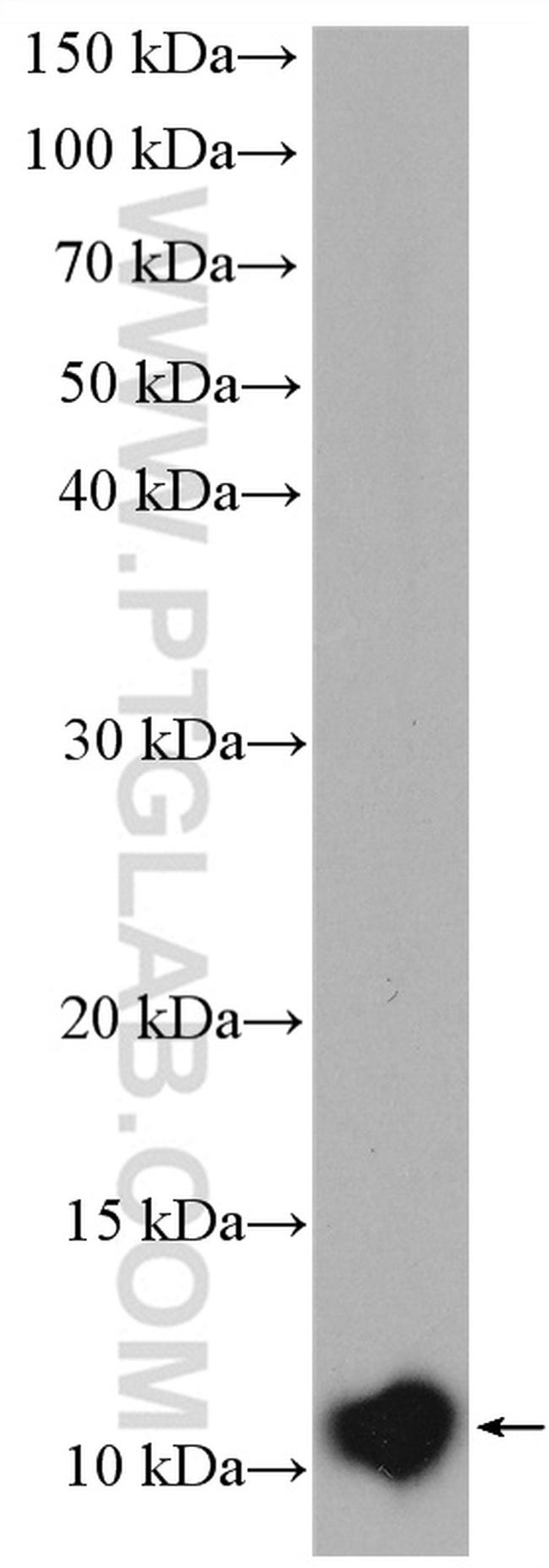 S100 beta Antibody in Western Blot (WB)