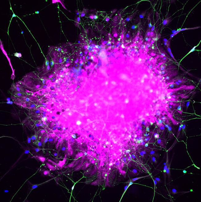 S100 beta Antibody in Immunocytochemistry (ICC/IF)