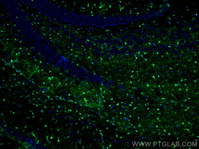 S100 beta Antibody in Immunohistochemistry (PFA fixed) (IHC (PFA))