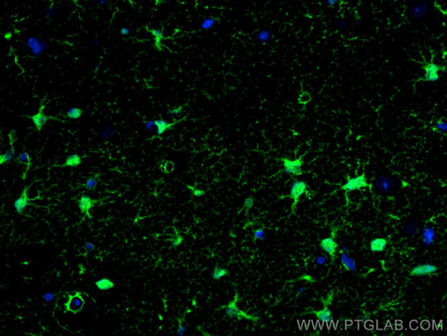 S100 beta Antibody in Immunohistochemistry (PFA fixed) (IHC (PFA))