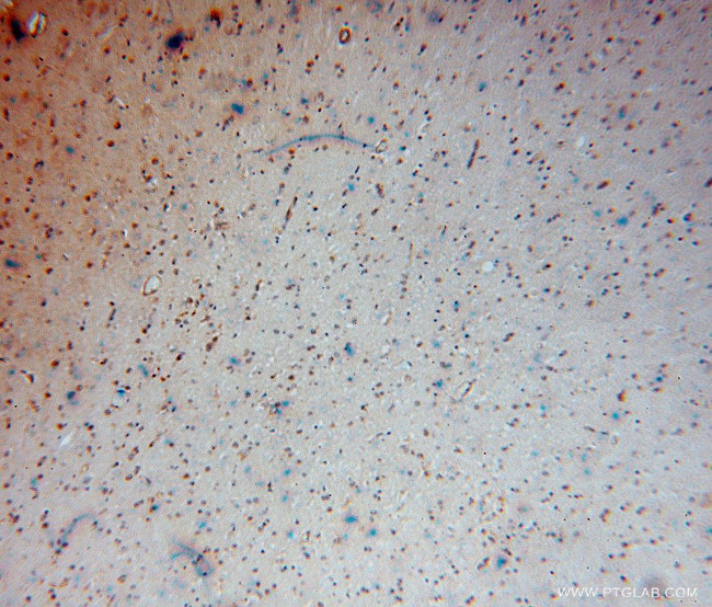 CEP68 Antibody in Immunohistochemistry (Paraffin) (IHC (P))