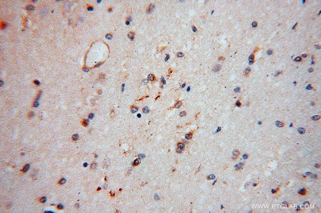 CEP68 Antibody in Immunohistochemistry (Paraffin) (IHC (P))