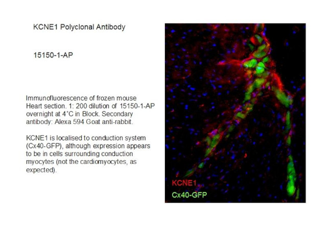 KCNE1 Antibody in Immunohistochemistry (Frozen) (IHC (F))