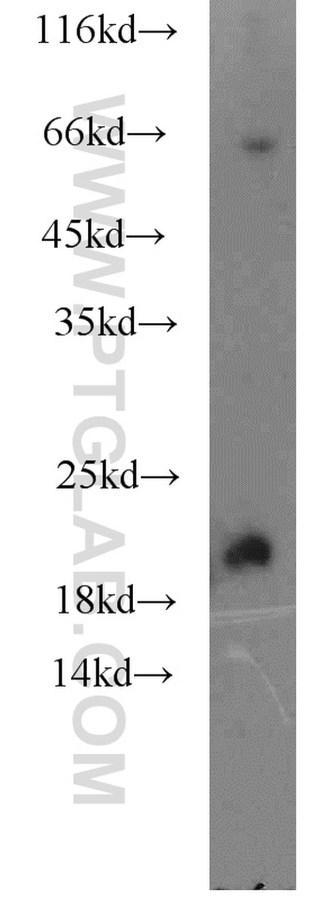 KCNE1 Antibody in Western Blot (WB)