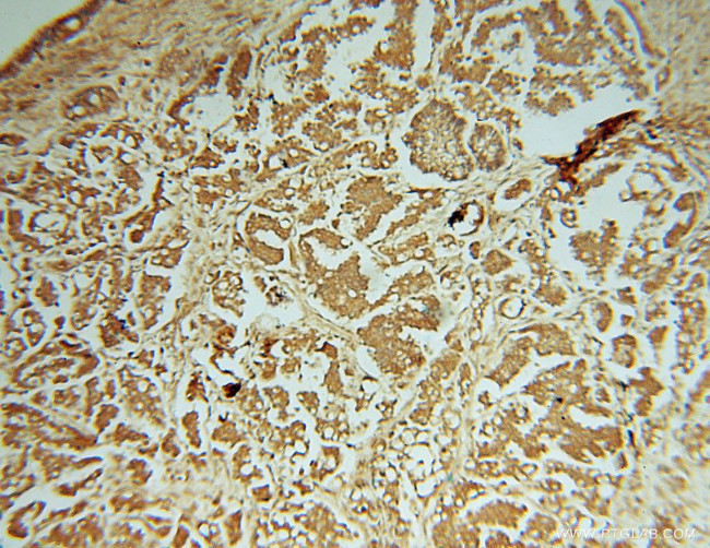 PIGK Antibody in Immunohistochemistry (Paraffin) (IHC (P))