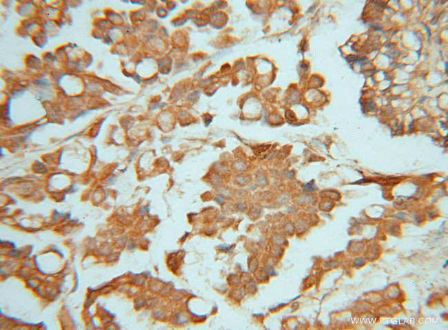 PIGK Antibody in Immunohistochemistry (Paraffin) (IHC (P))