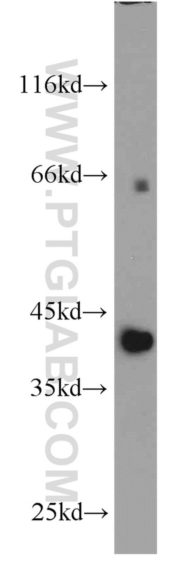 PIGK Antibody in Western Blot (WB)