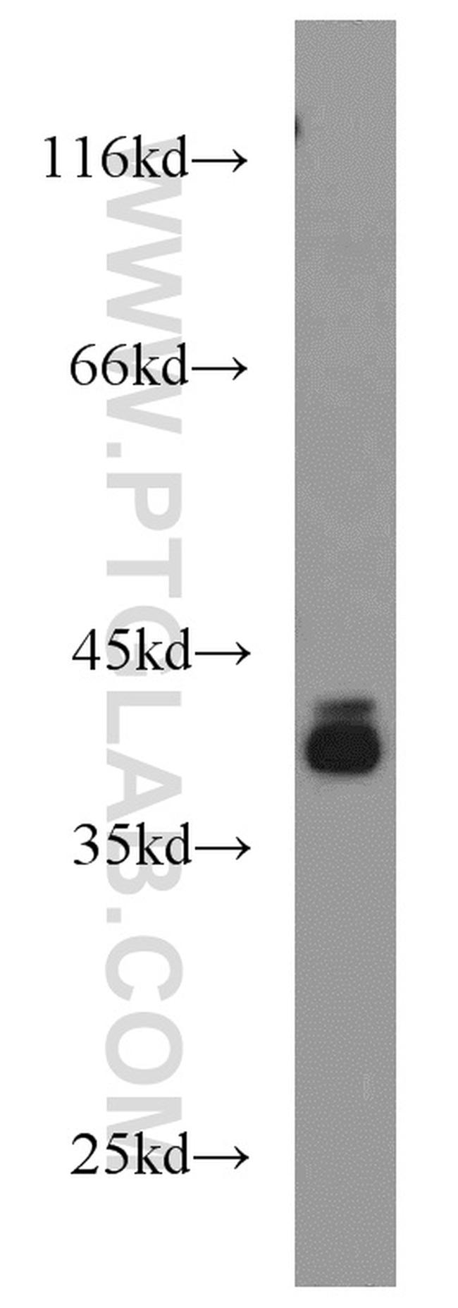 PIGK Antibody in Western Blot (WB)