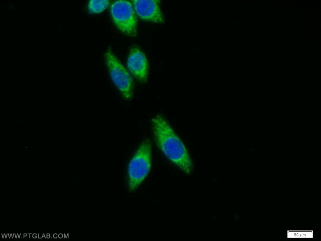 SFXN3 Antibody in Immunocytochemistry (ICC/IF)