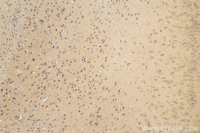 SFXN3 Antibody in Immunohistochemistry (Paraffin) (IHC (P))