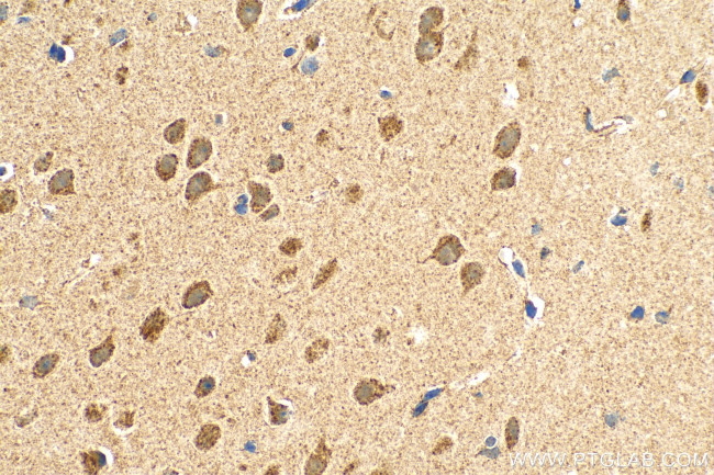 SFXN3 Antibody in Immunohistochemistry (Paraffin) (IHC (P))