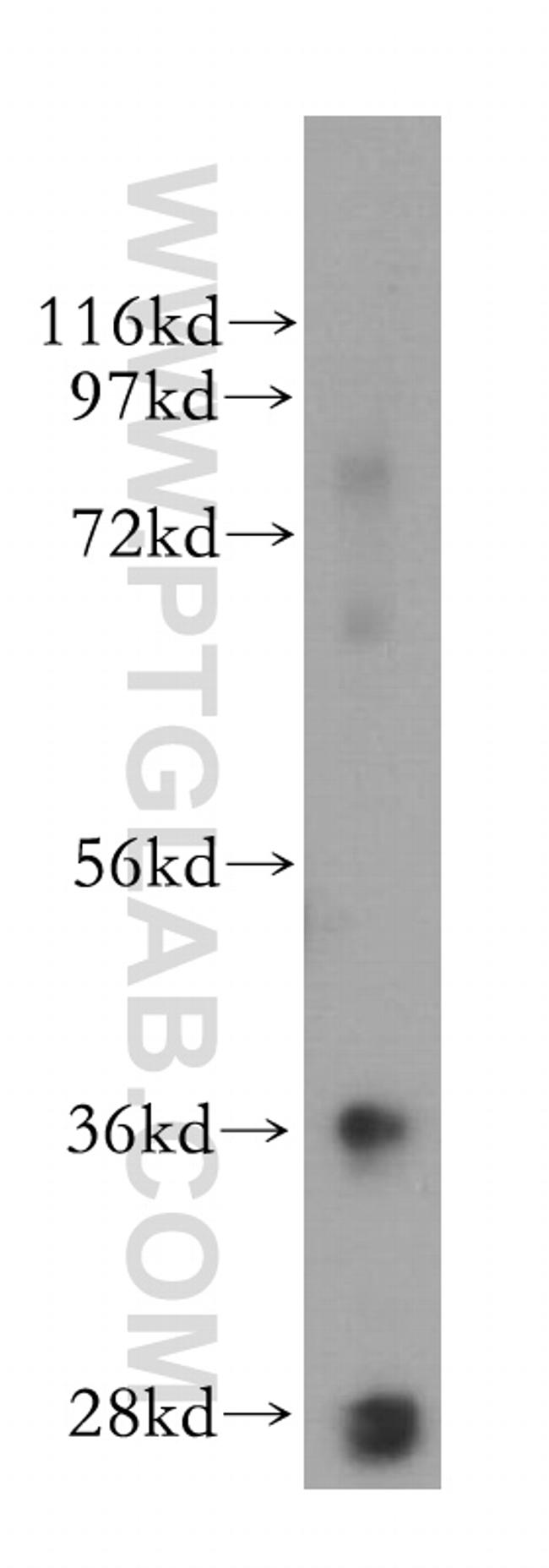 SFXN3 Antibody in Western Blot (WB)