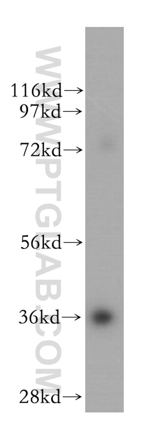 SFXN3 Antibody in Western Blot (WB)