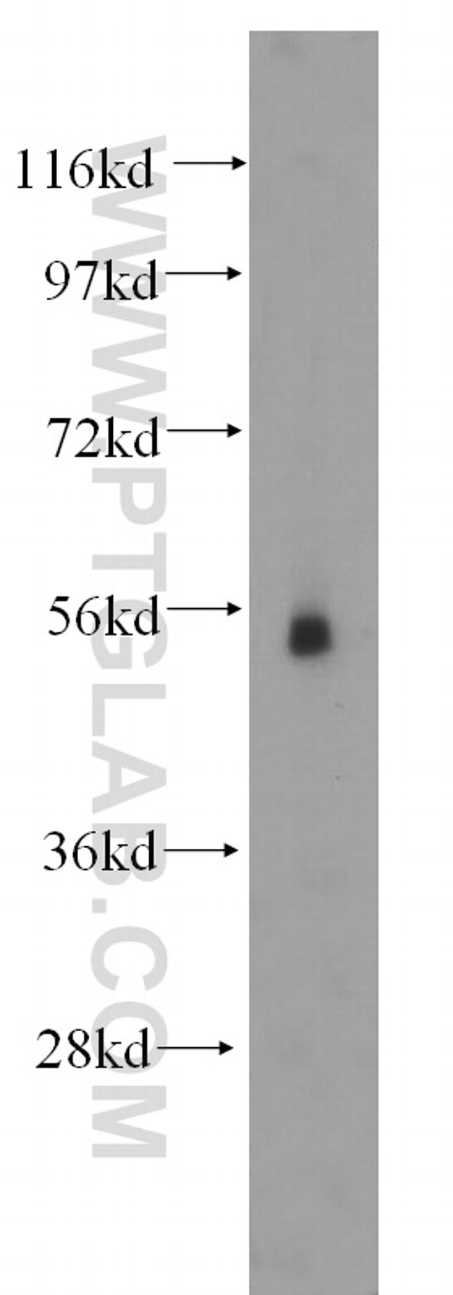 FUCA2 Antibody in Western Blot (WB)