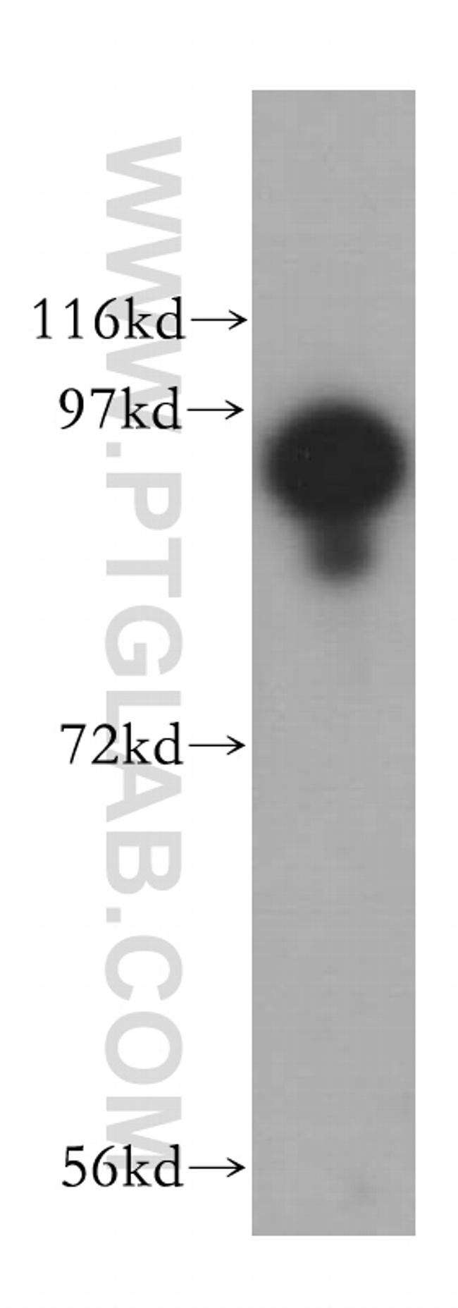 USP5 Antibody in Western Blot (WB)