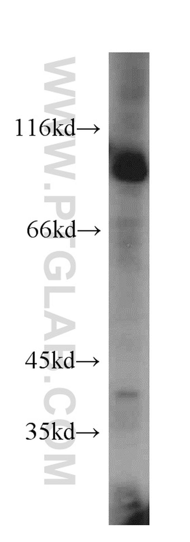 USP5 Antibody in Western Blot (WB)